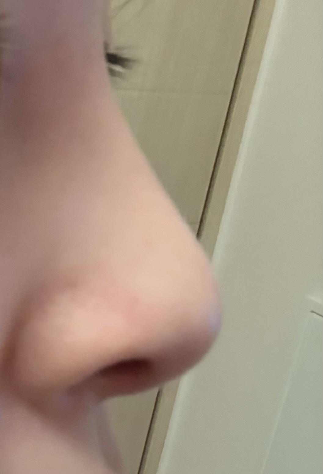 後