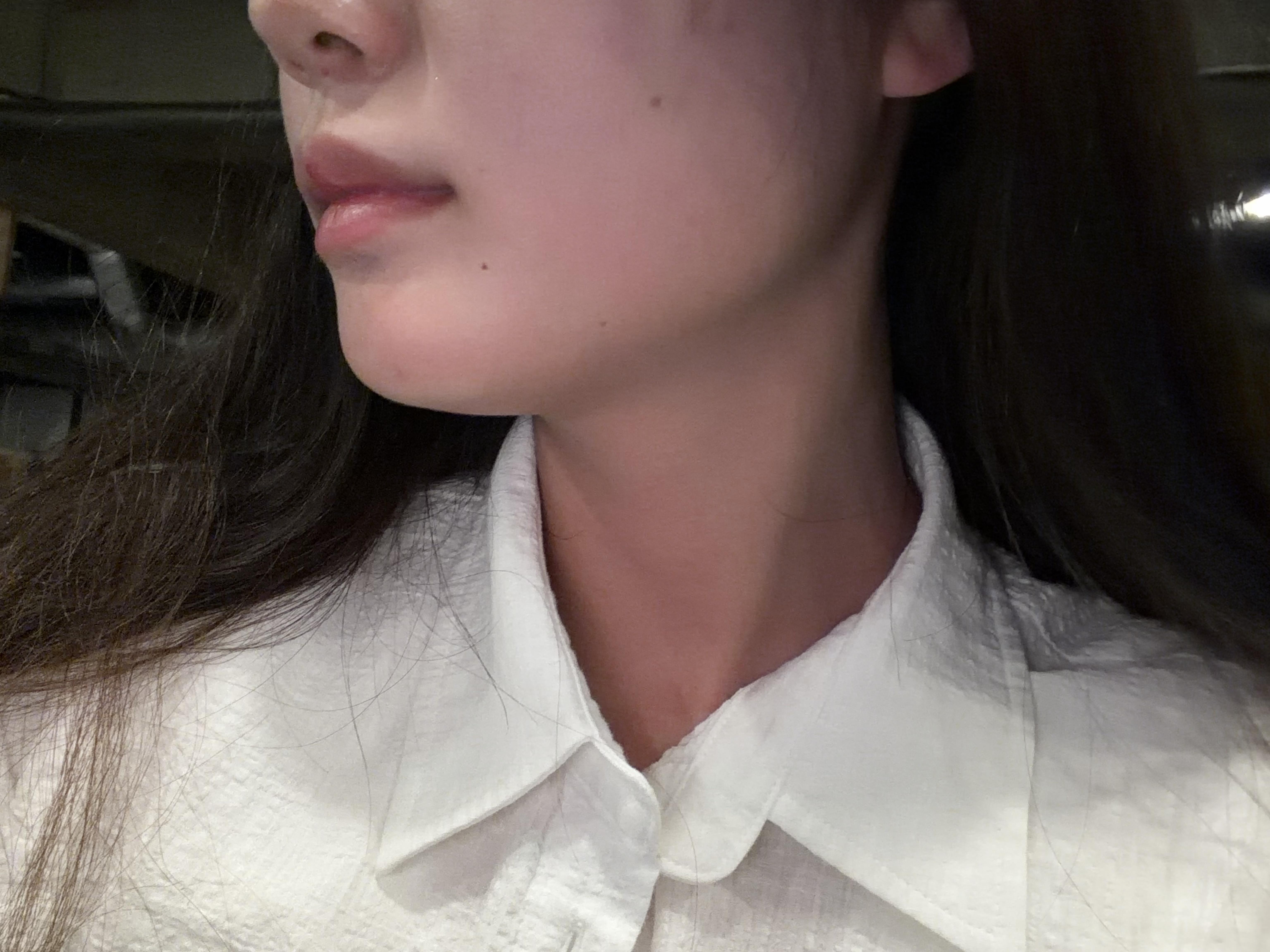 後