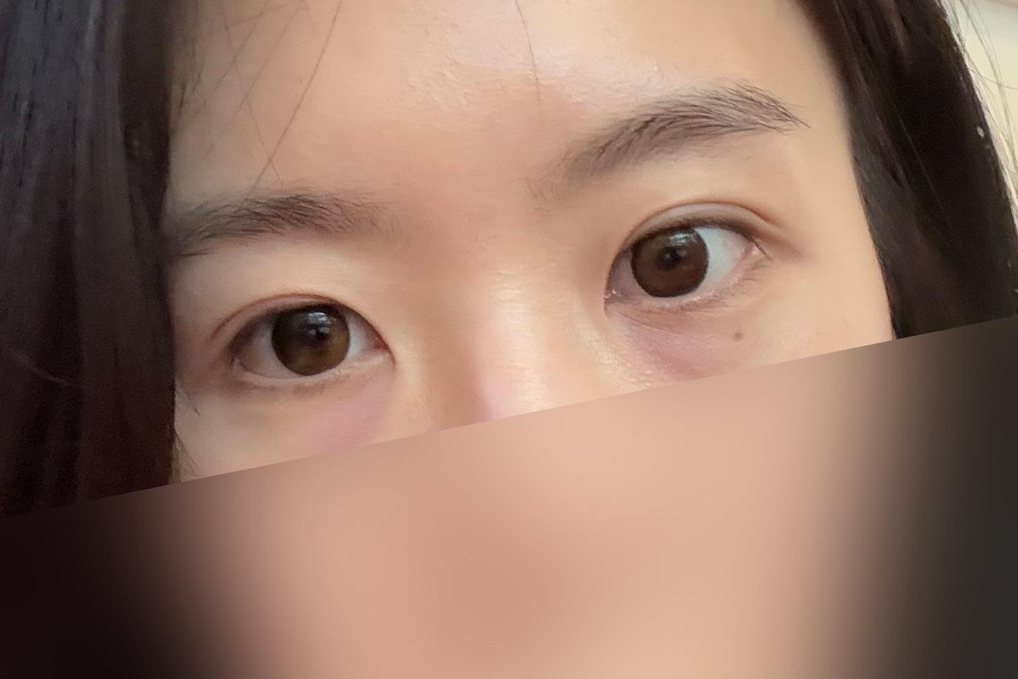 後