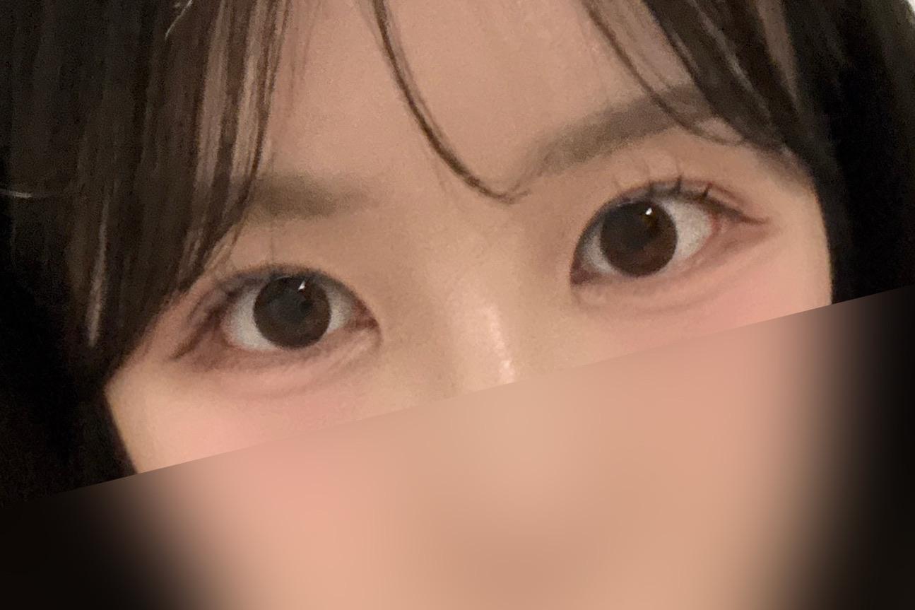 後