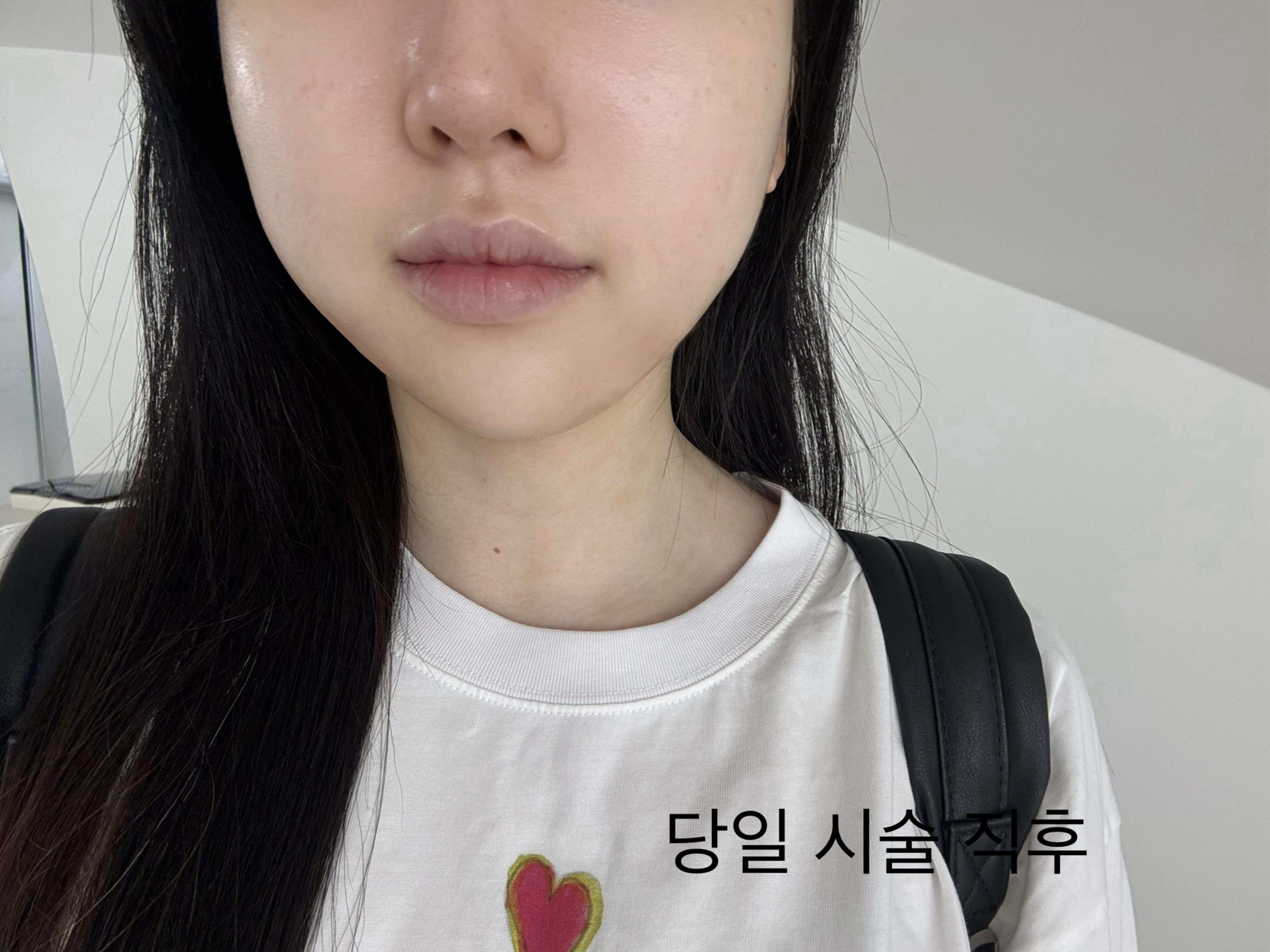 後
