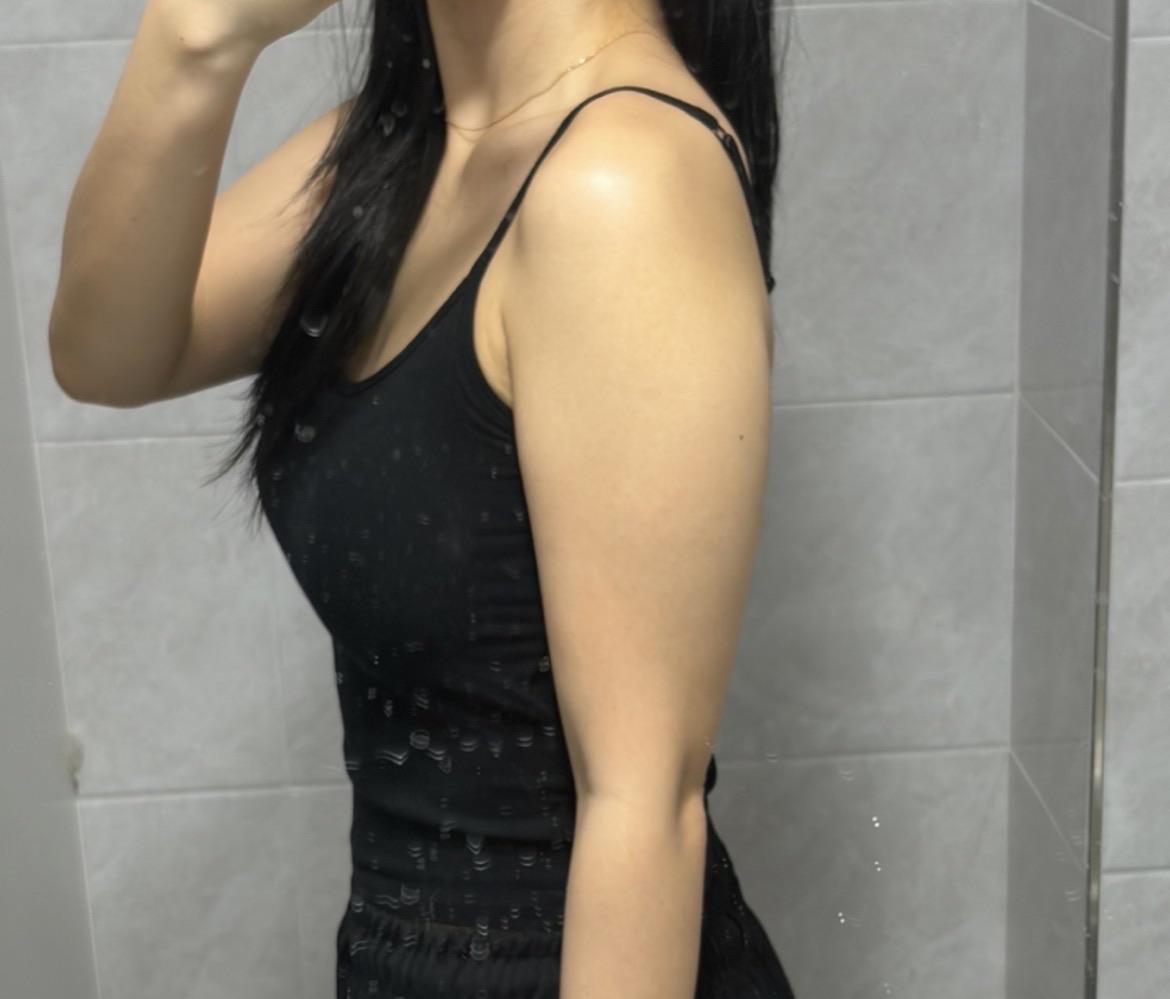 後