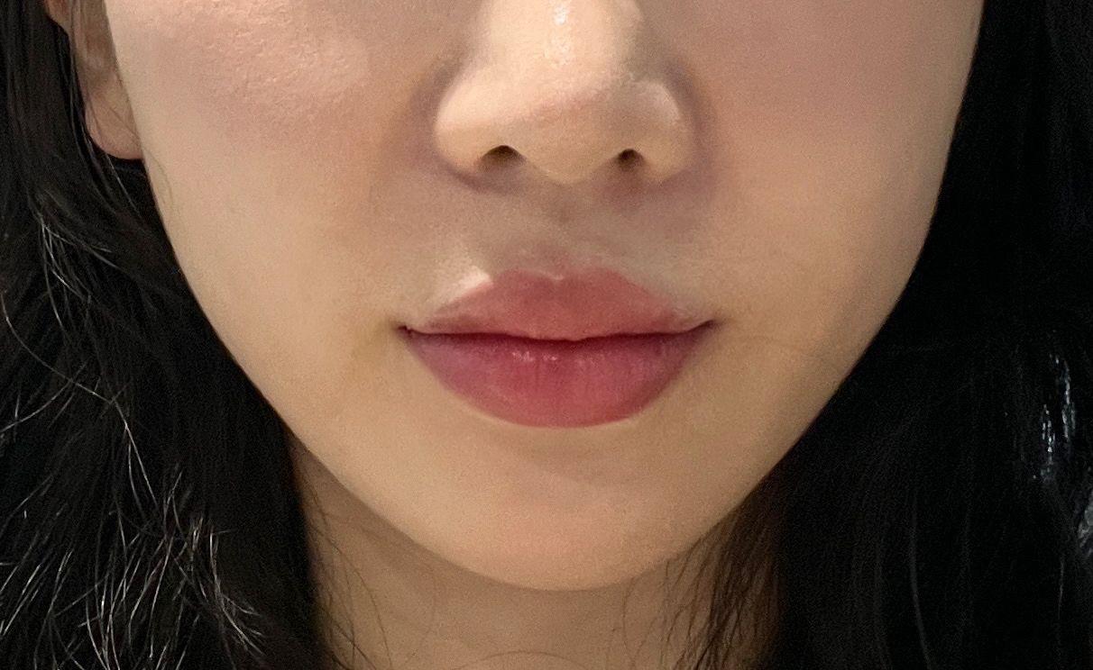 後