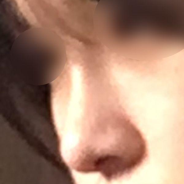 后