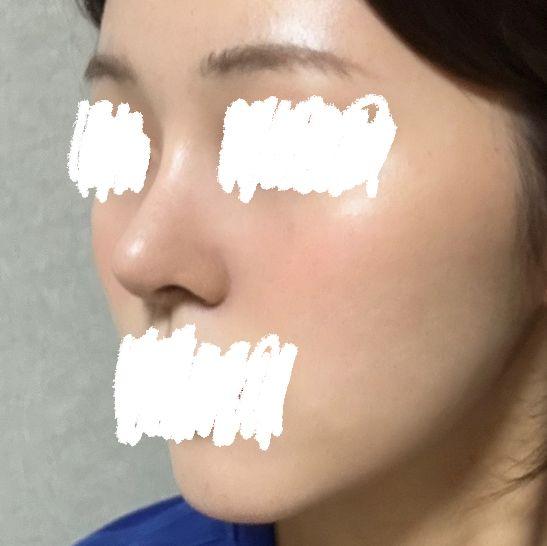 後