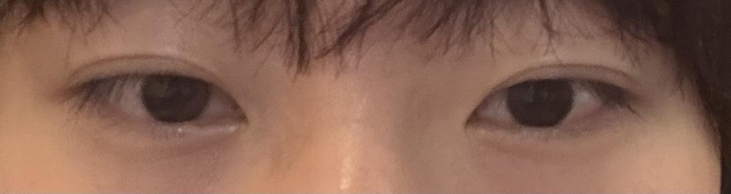 後