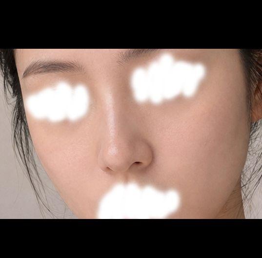 後