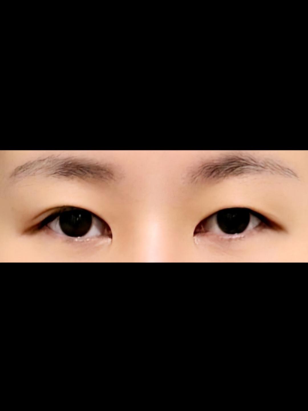 後