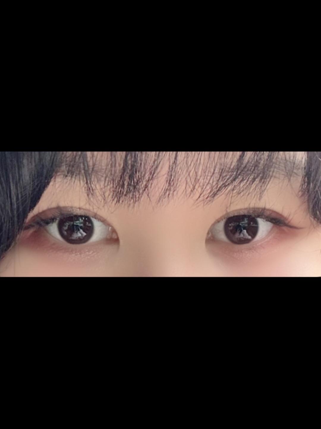 後