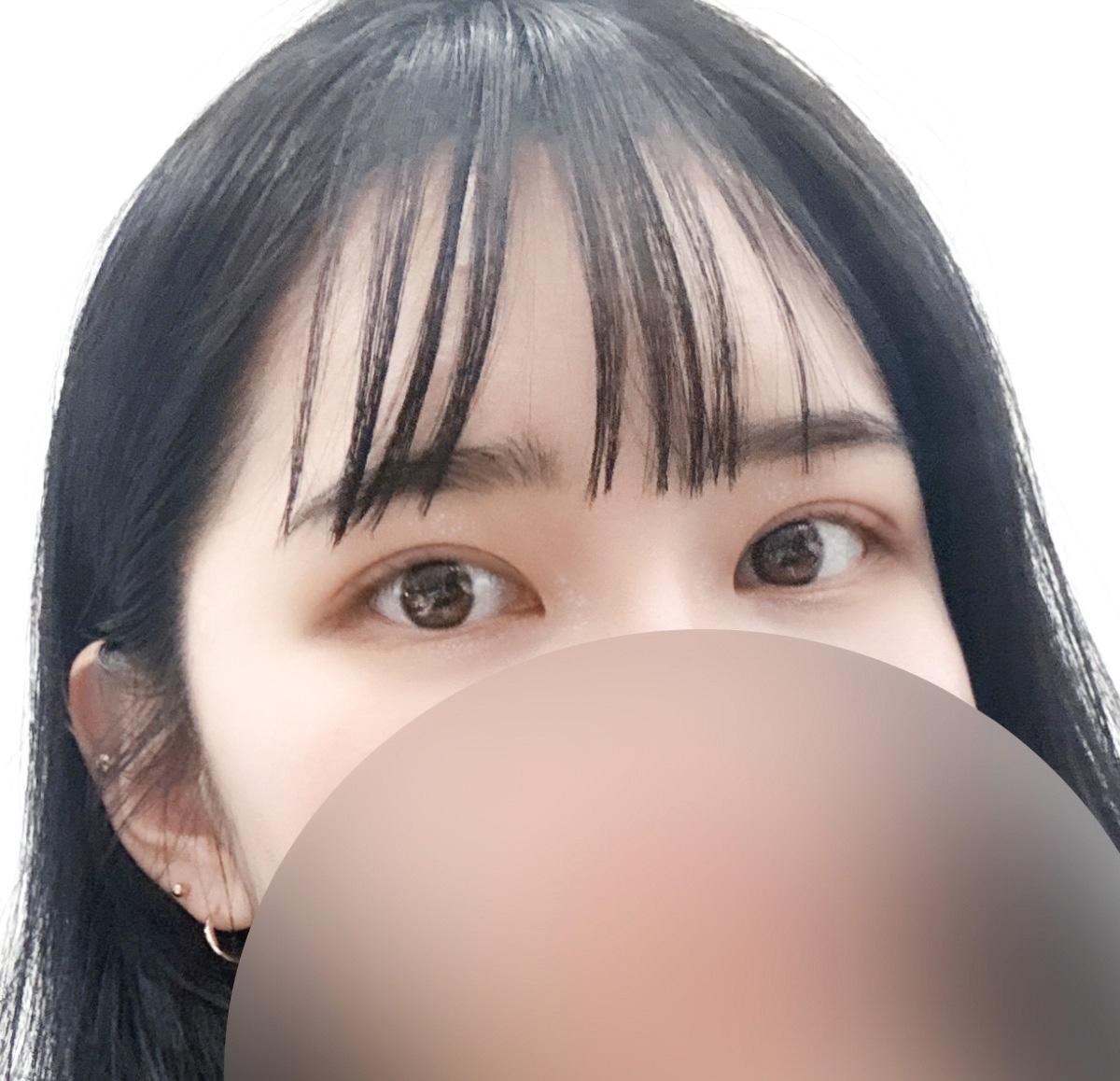 後