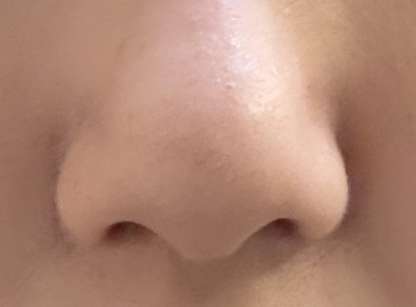 後