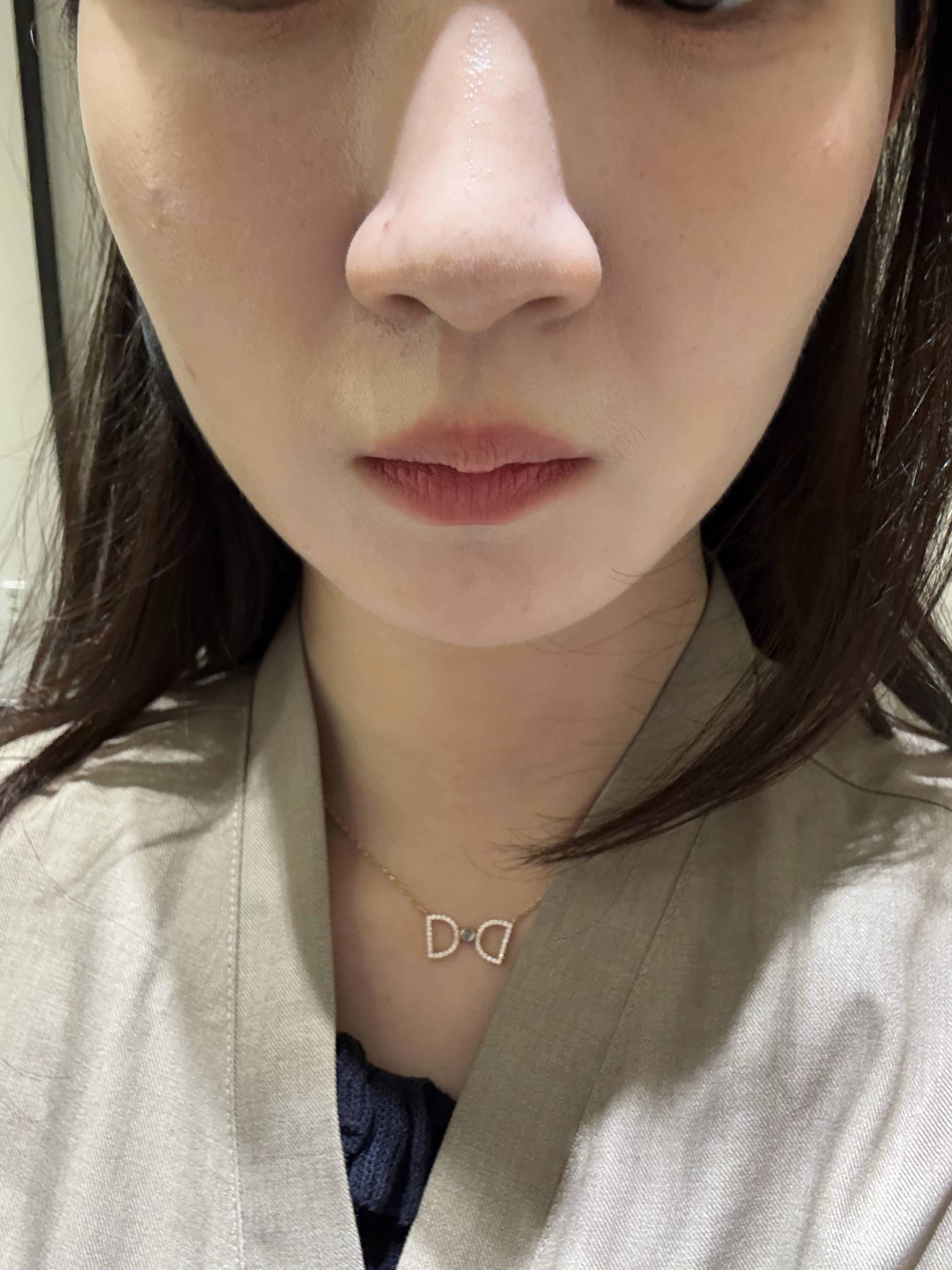 後
