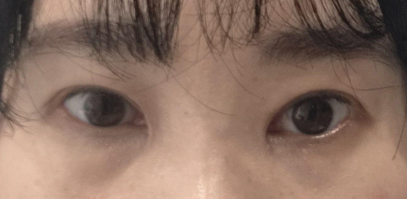 後