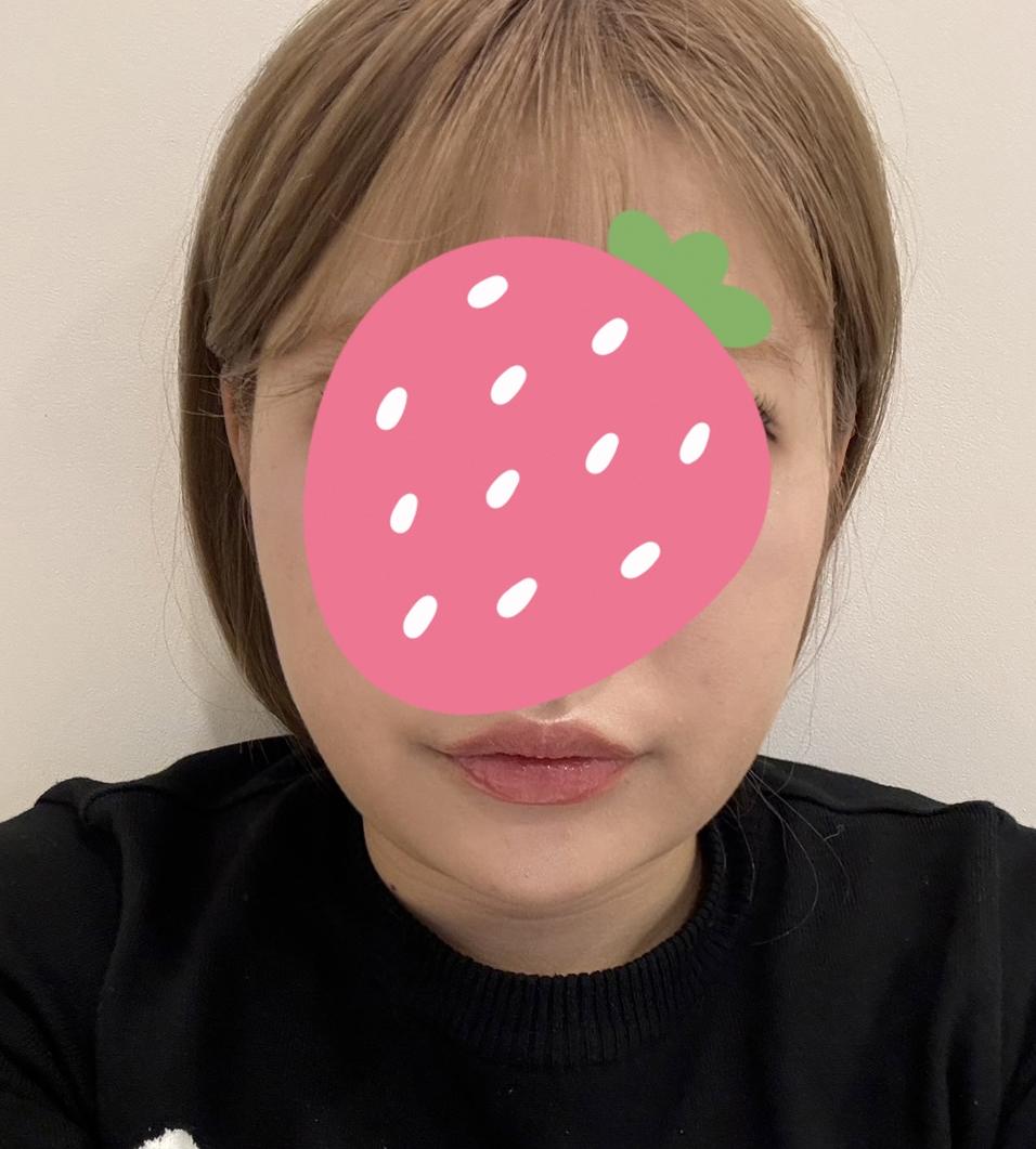 後