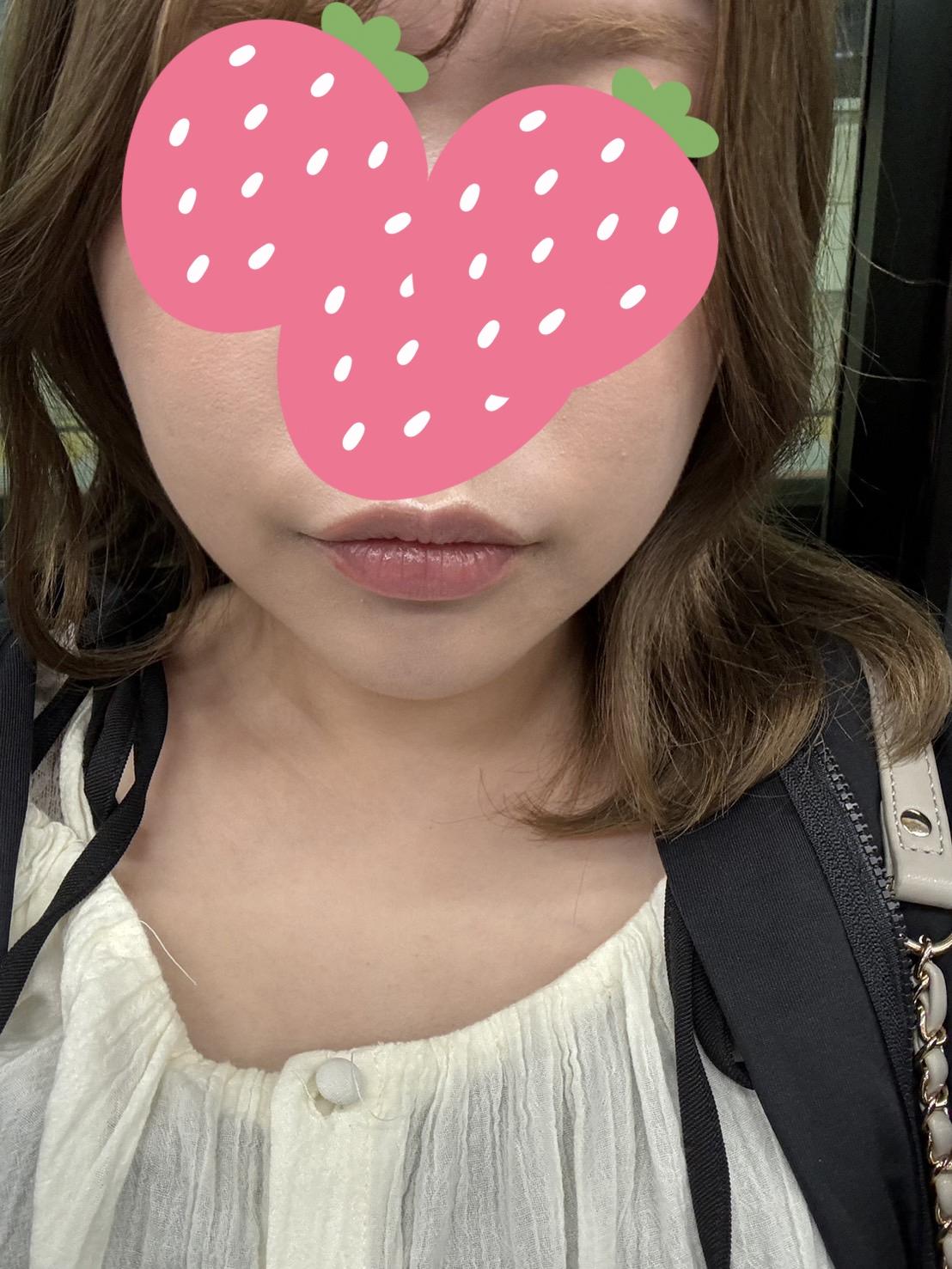 後