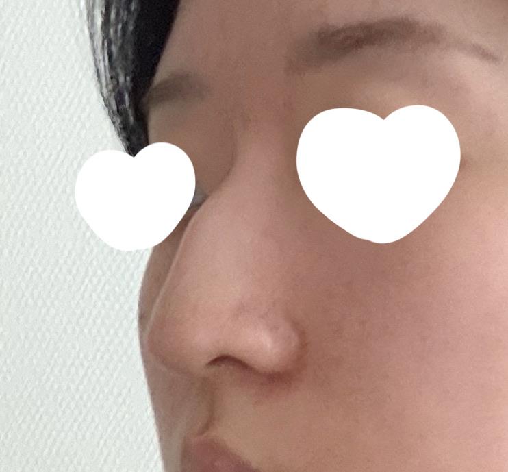 後