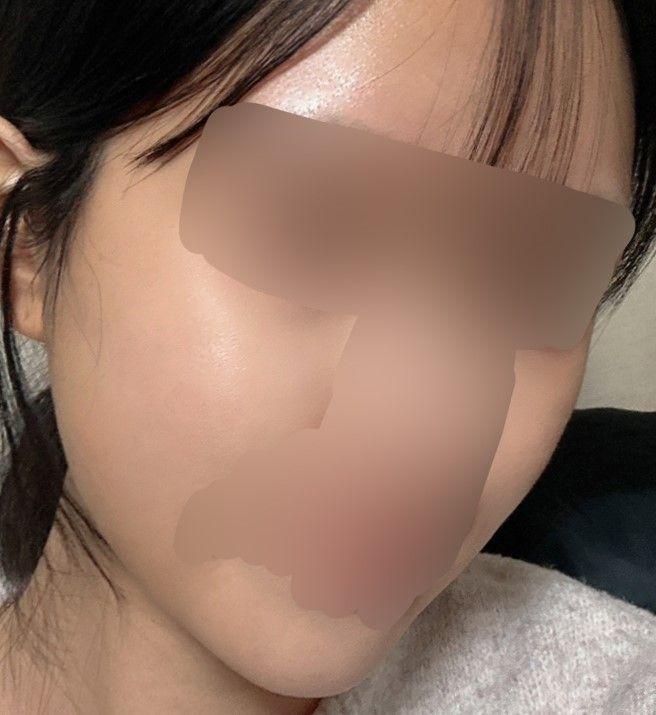 後