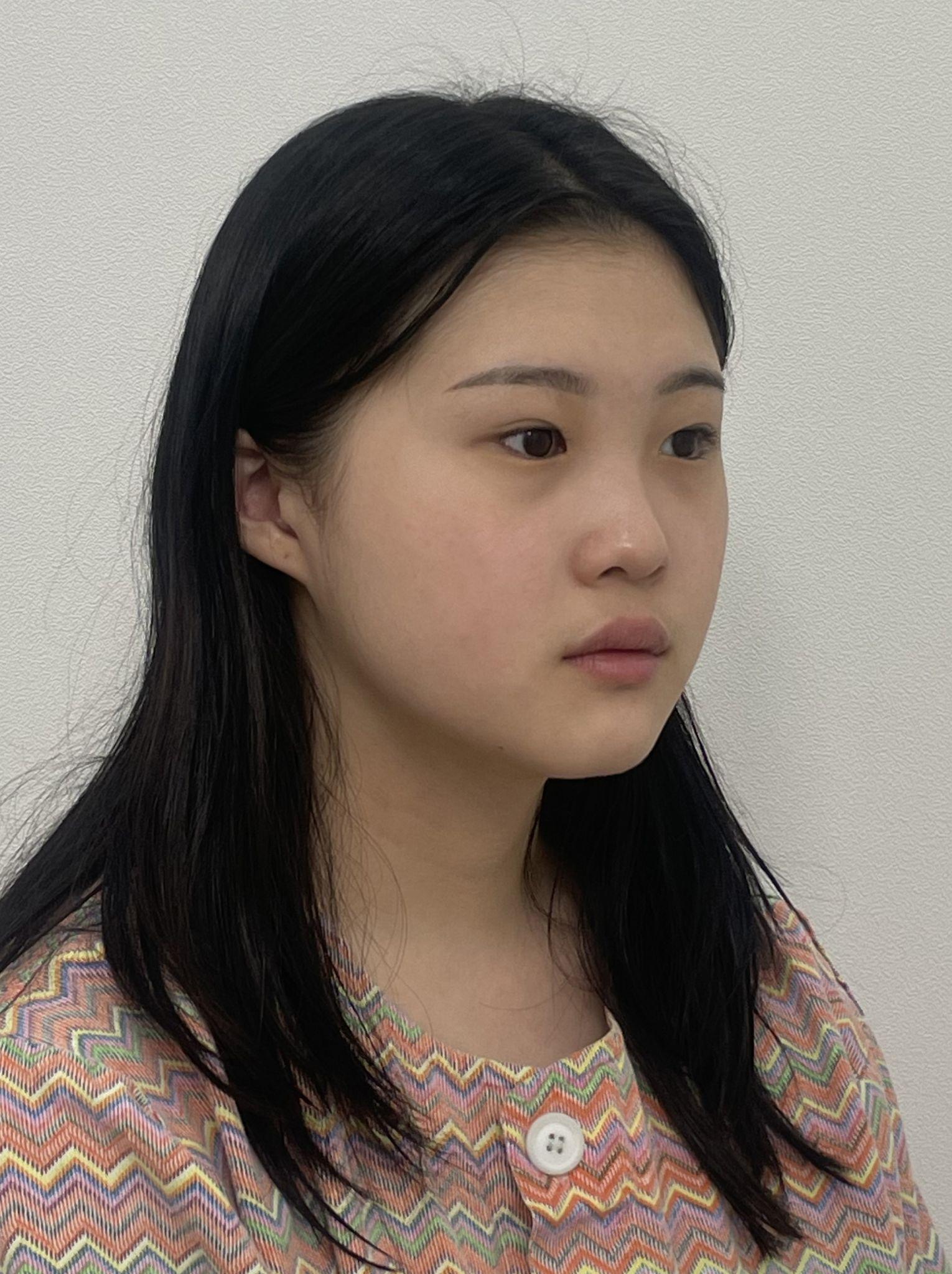 後