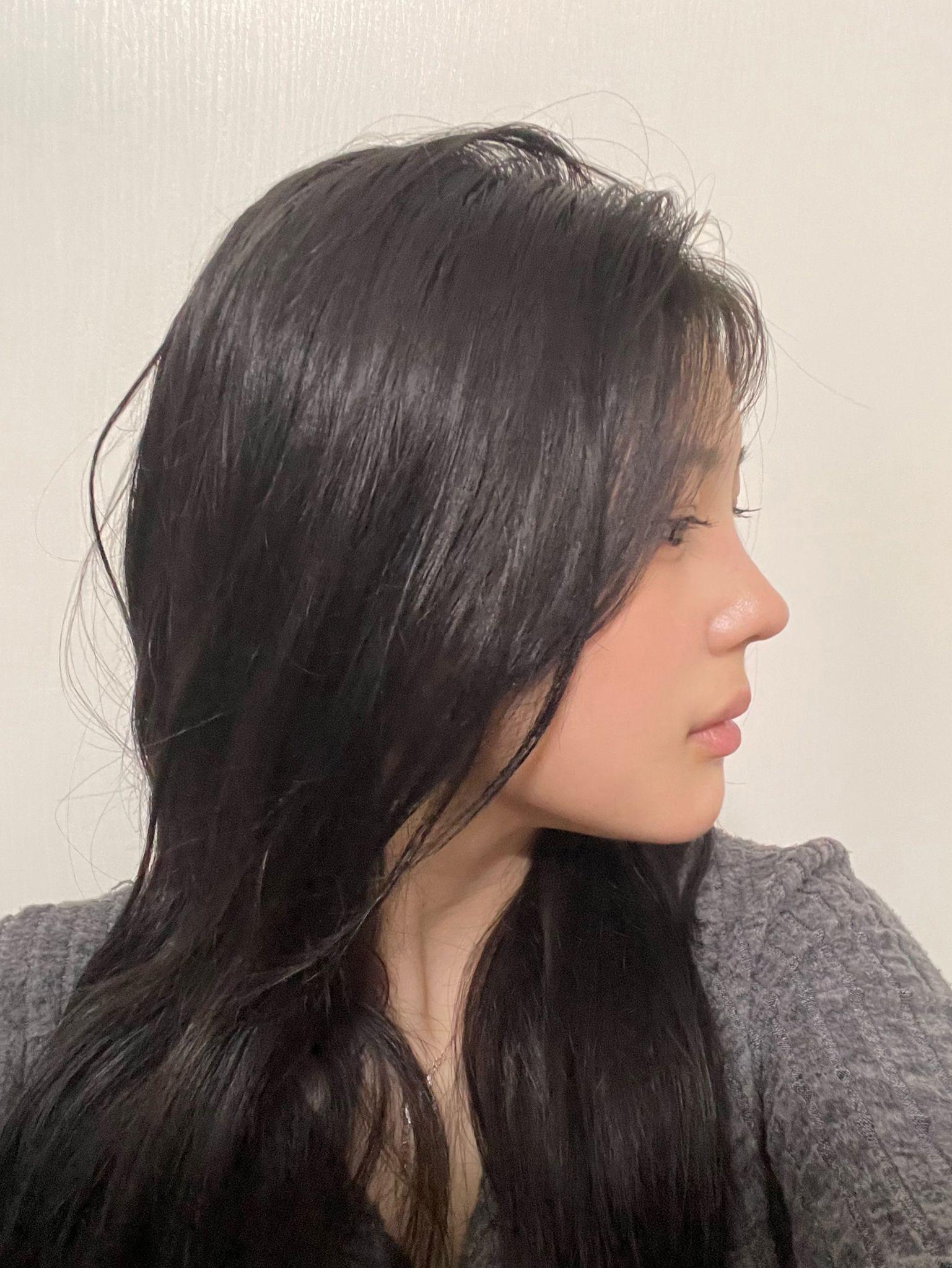 後