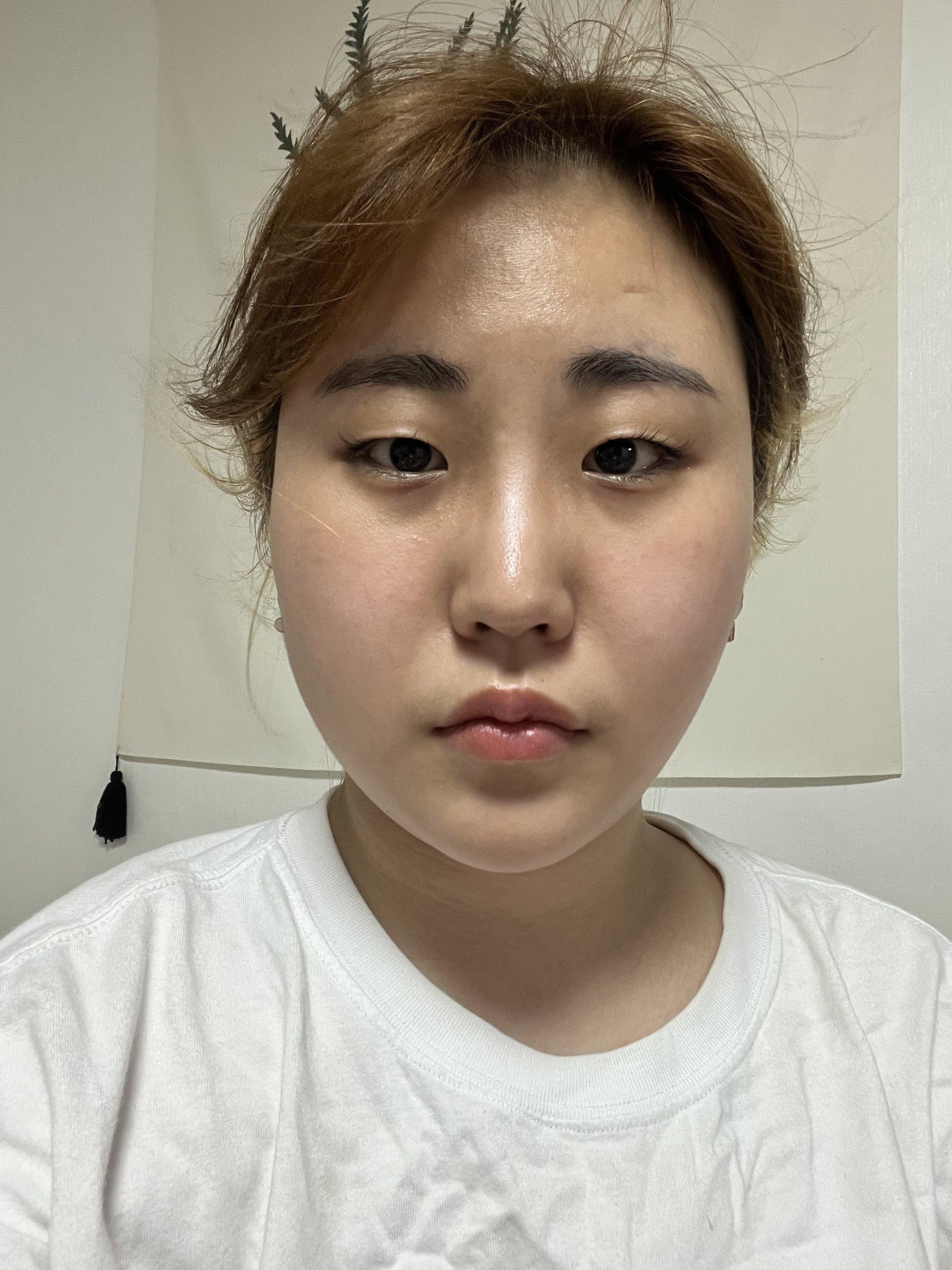 後