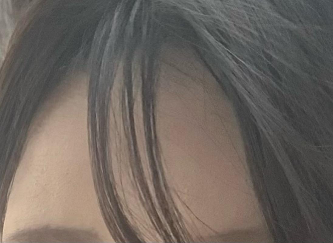 後