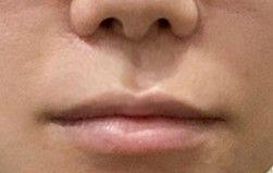 後