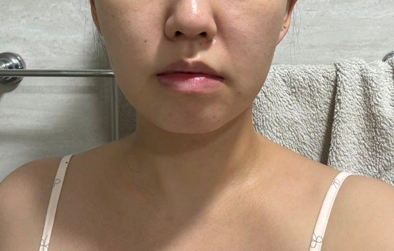 後