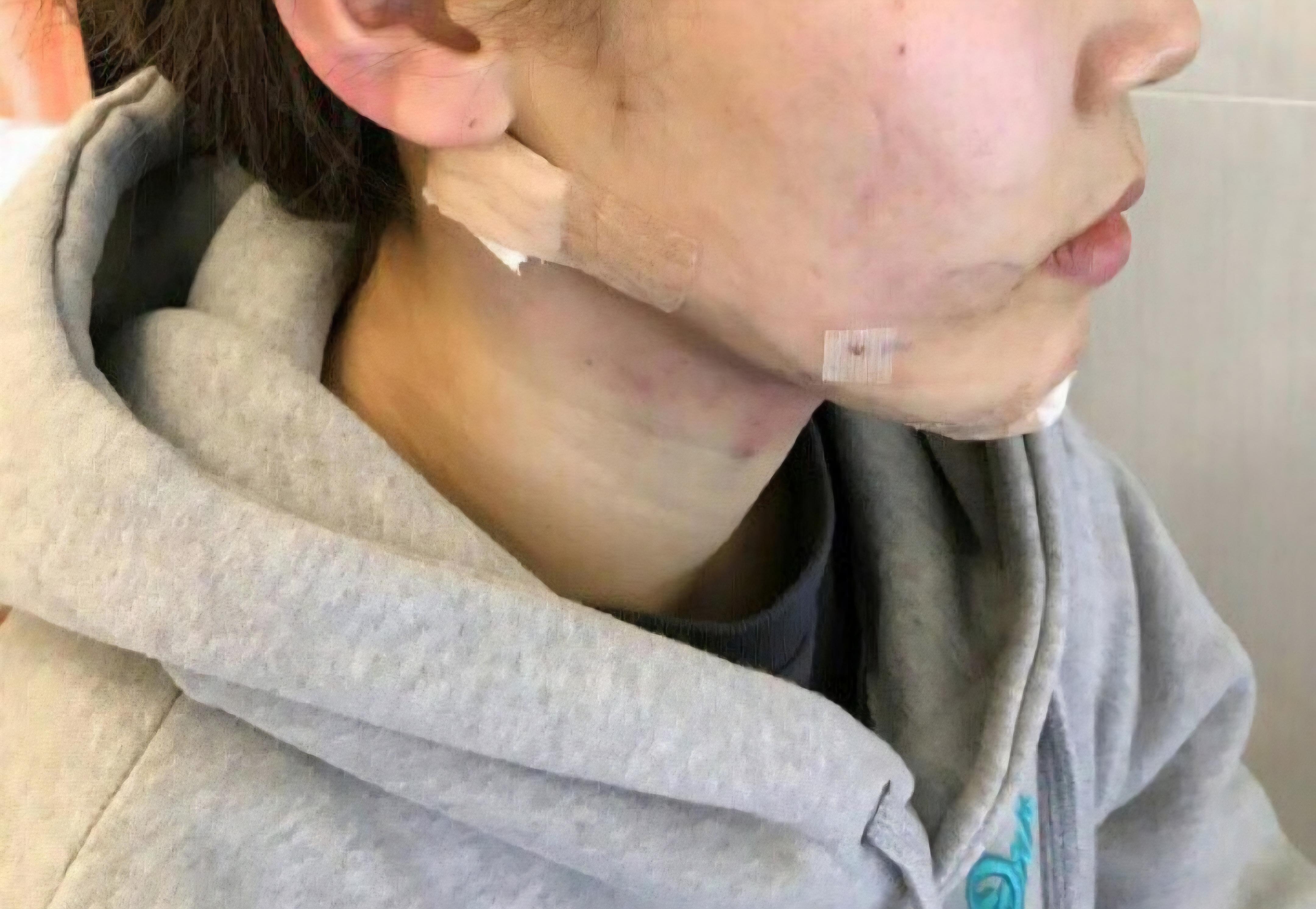 後