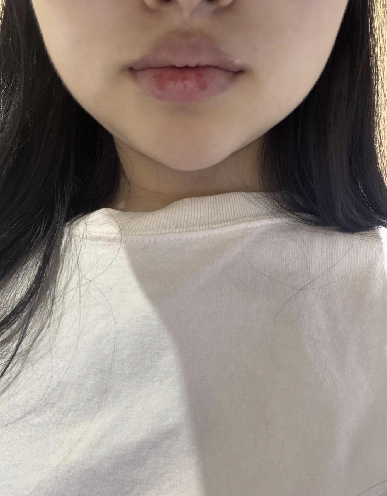 後