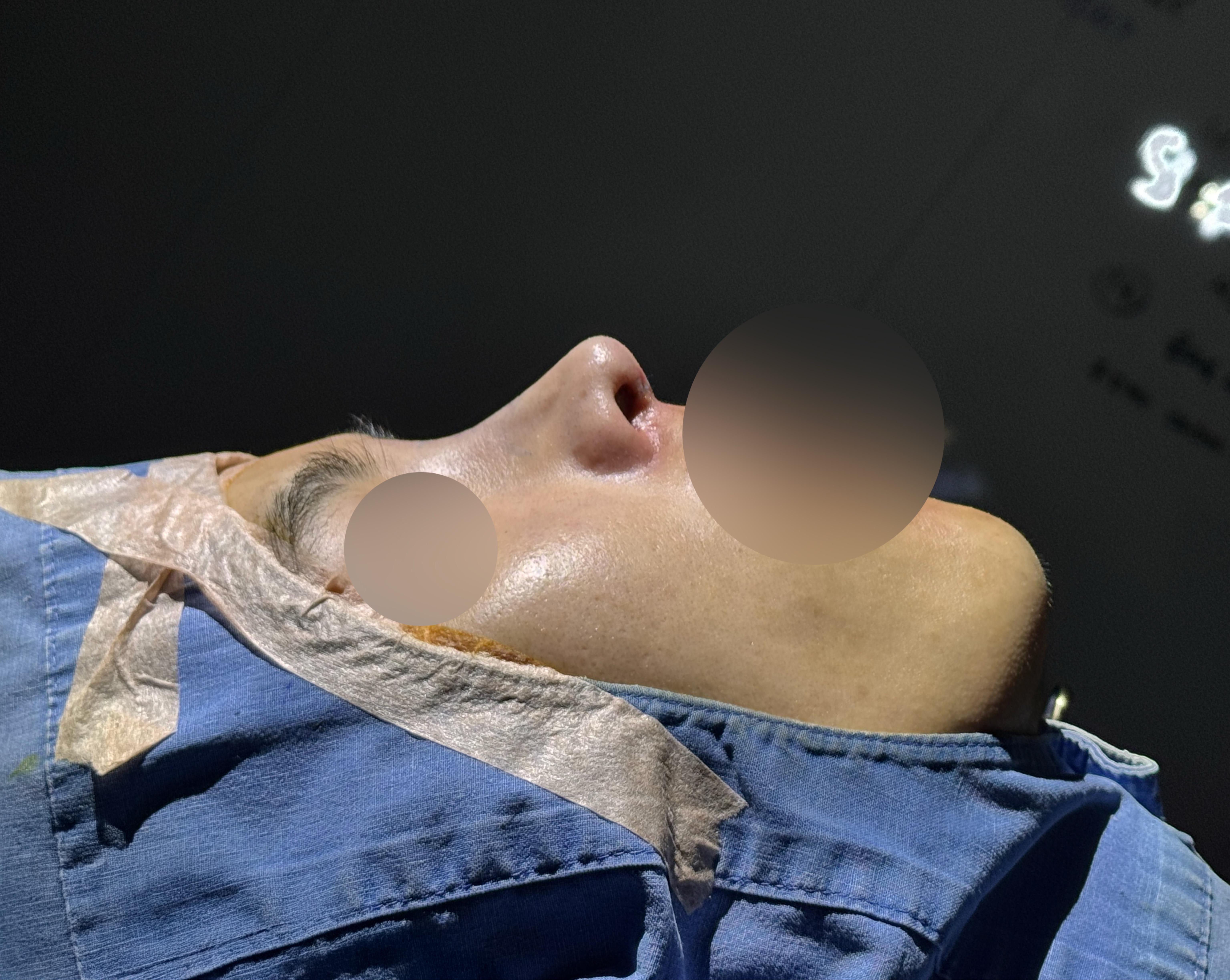 後