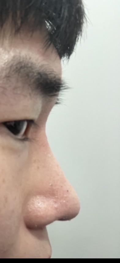 後