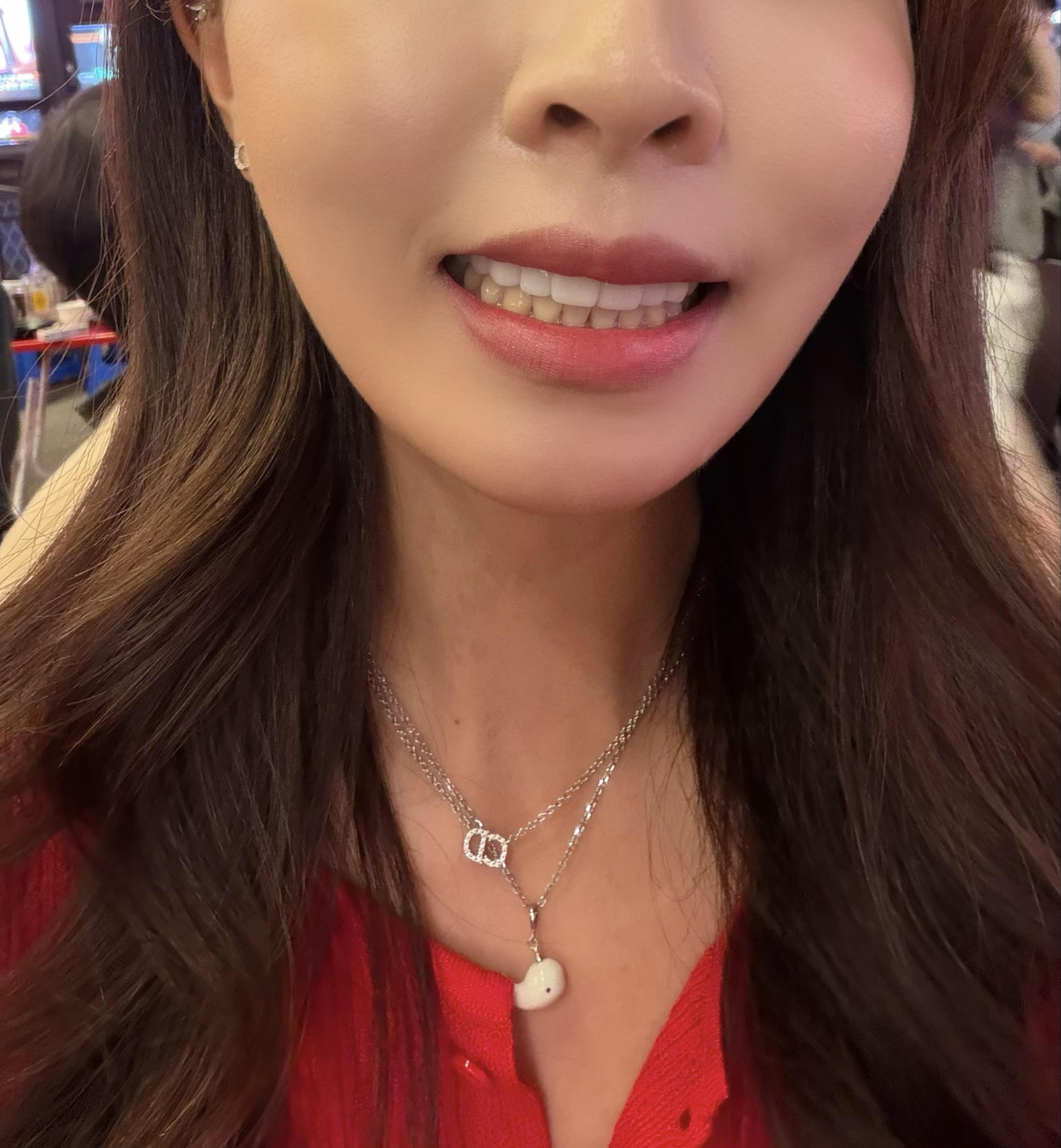 後
