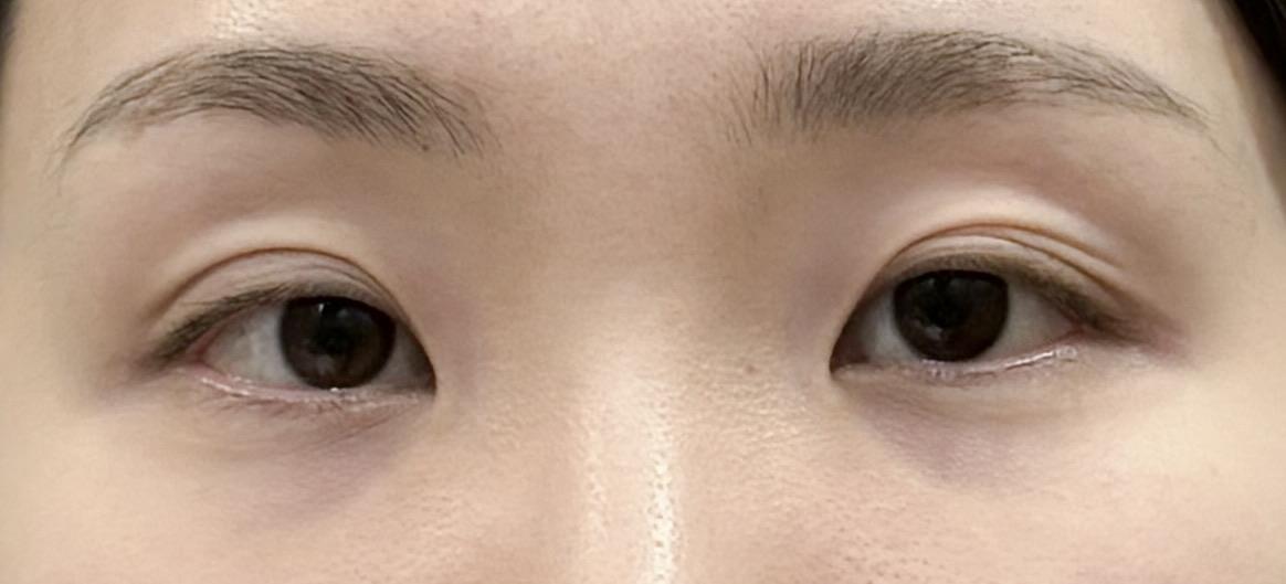 前