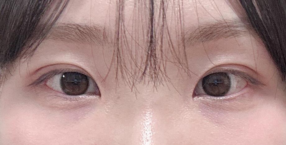后