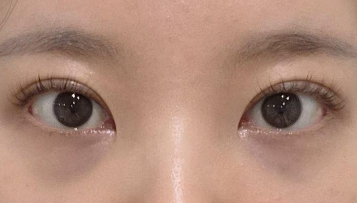 後