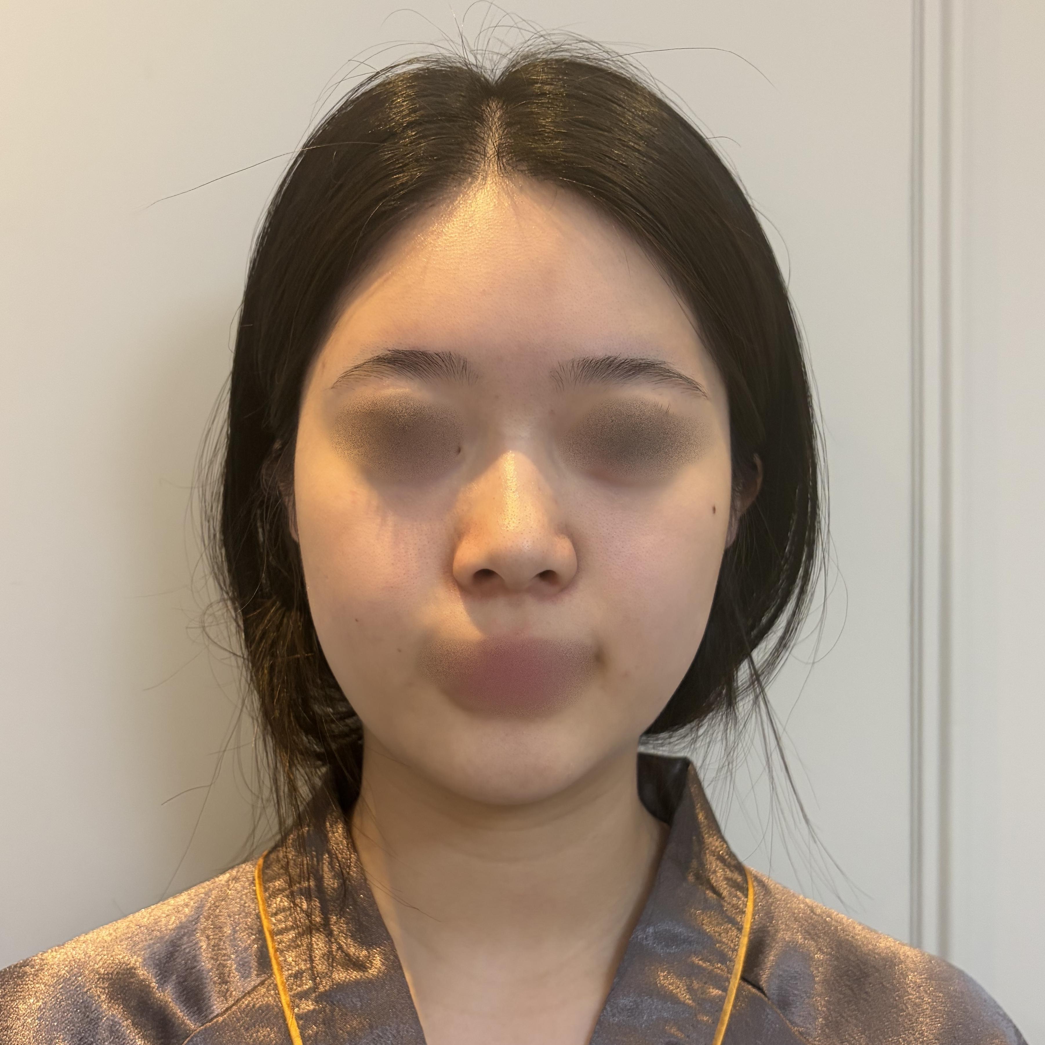 後