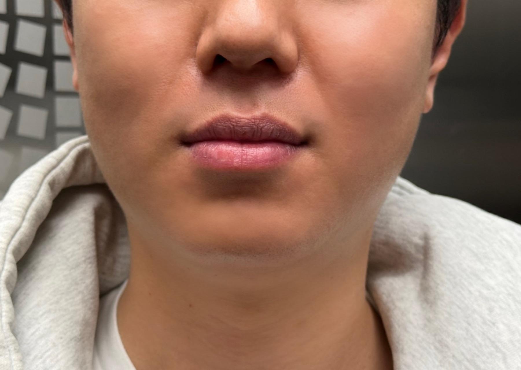 後