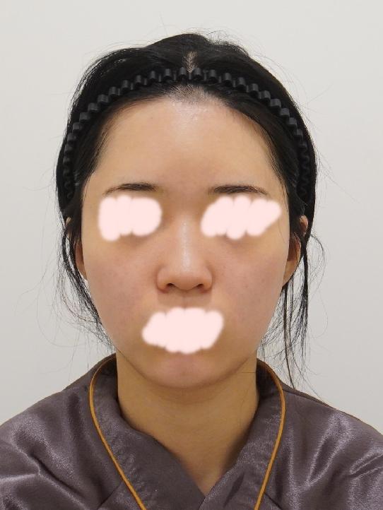 後