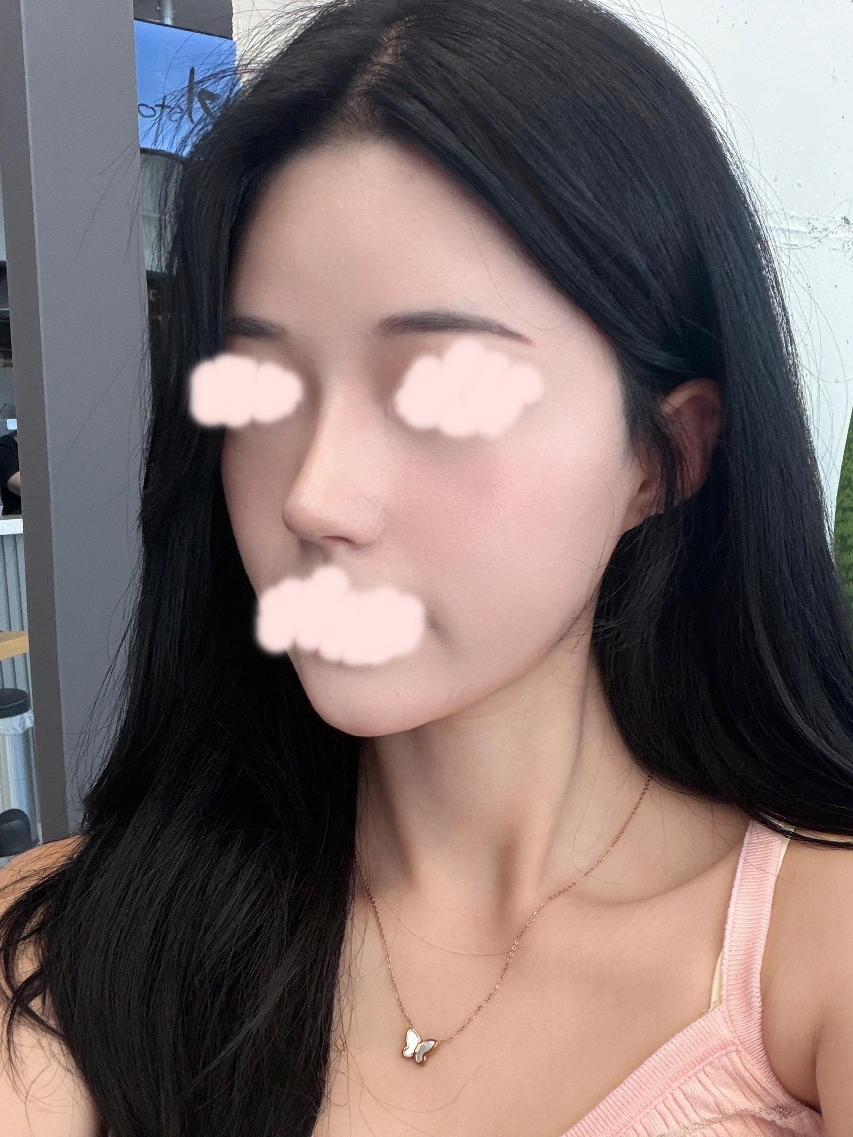 後