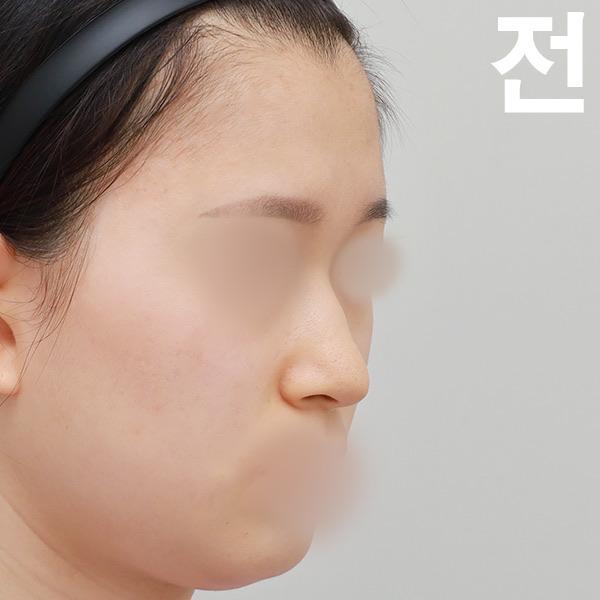 後