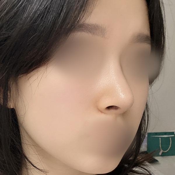 後