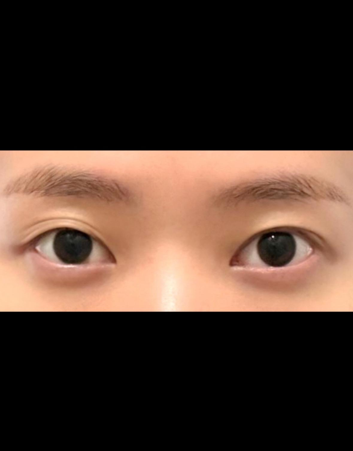 後
