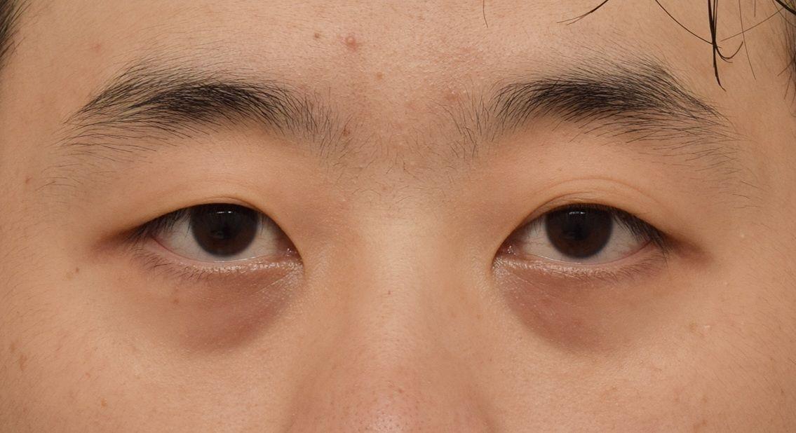 後