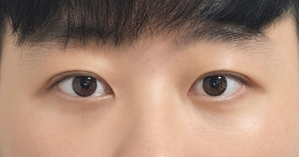 後