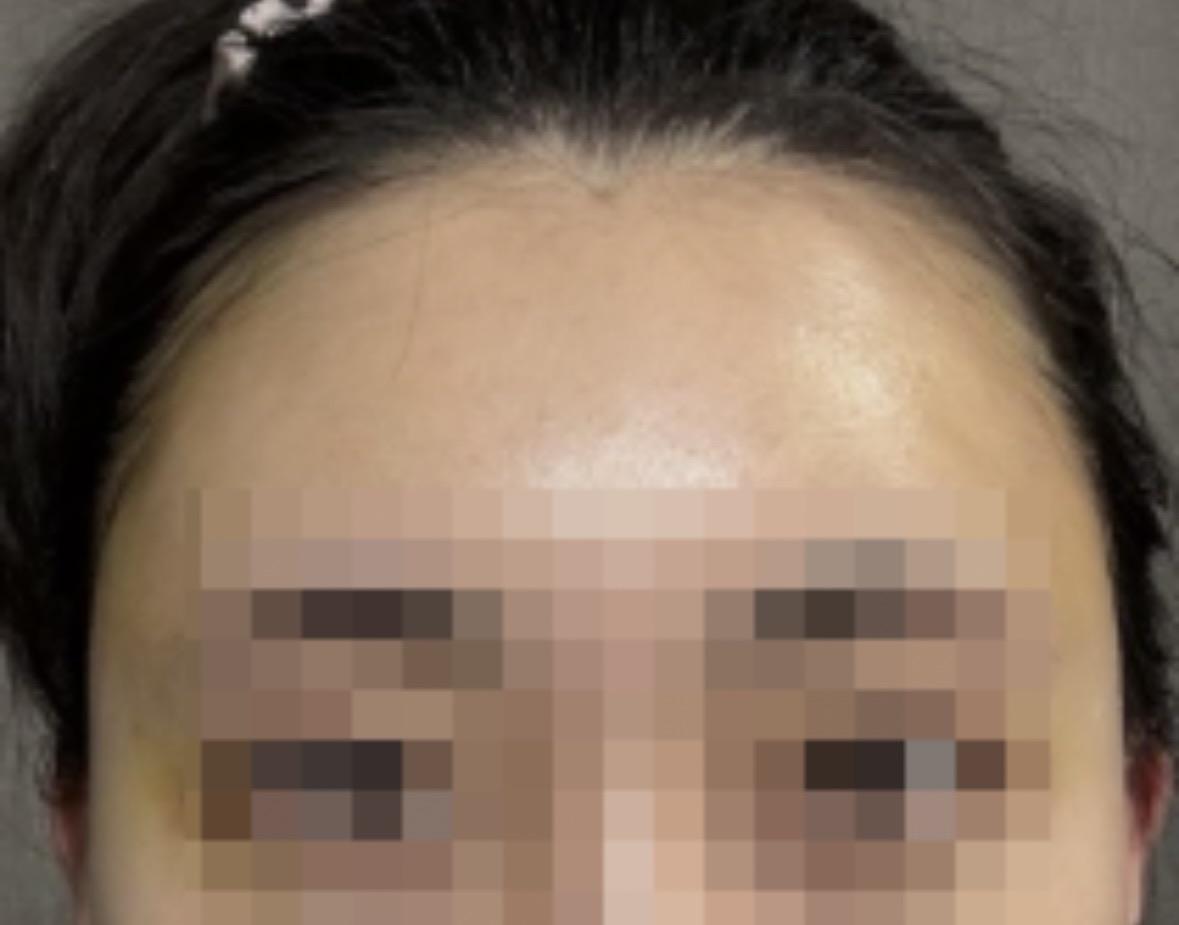 後