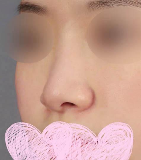 前