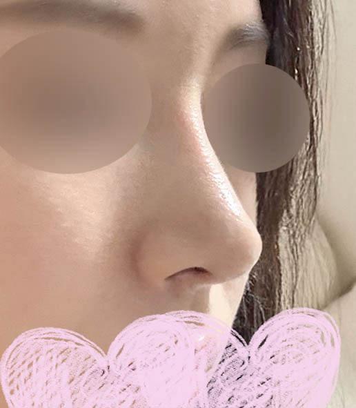 后