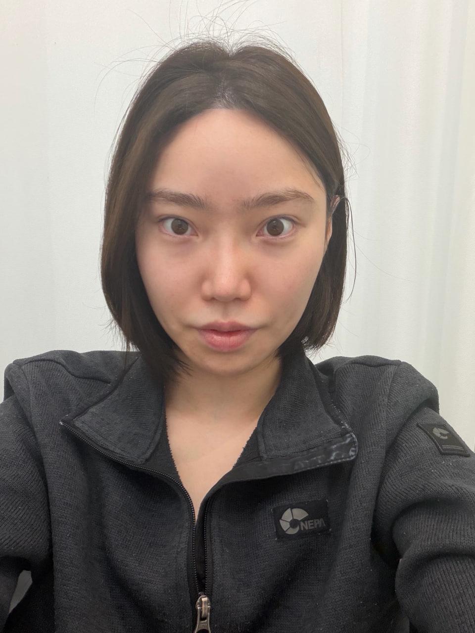 後