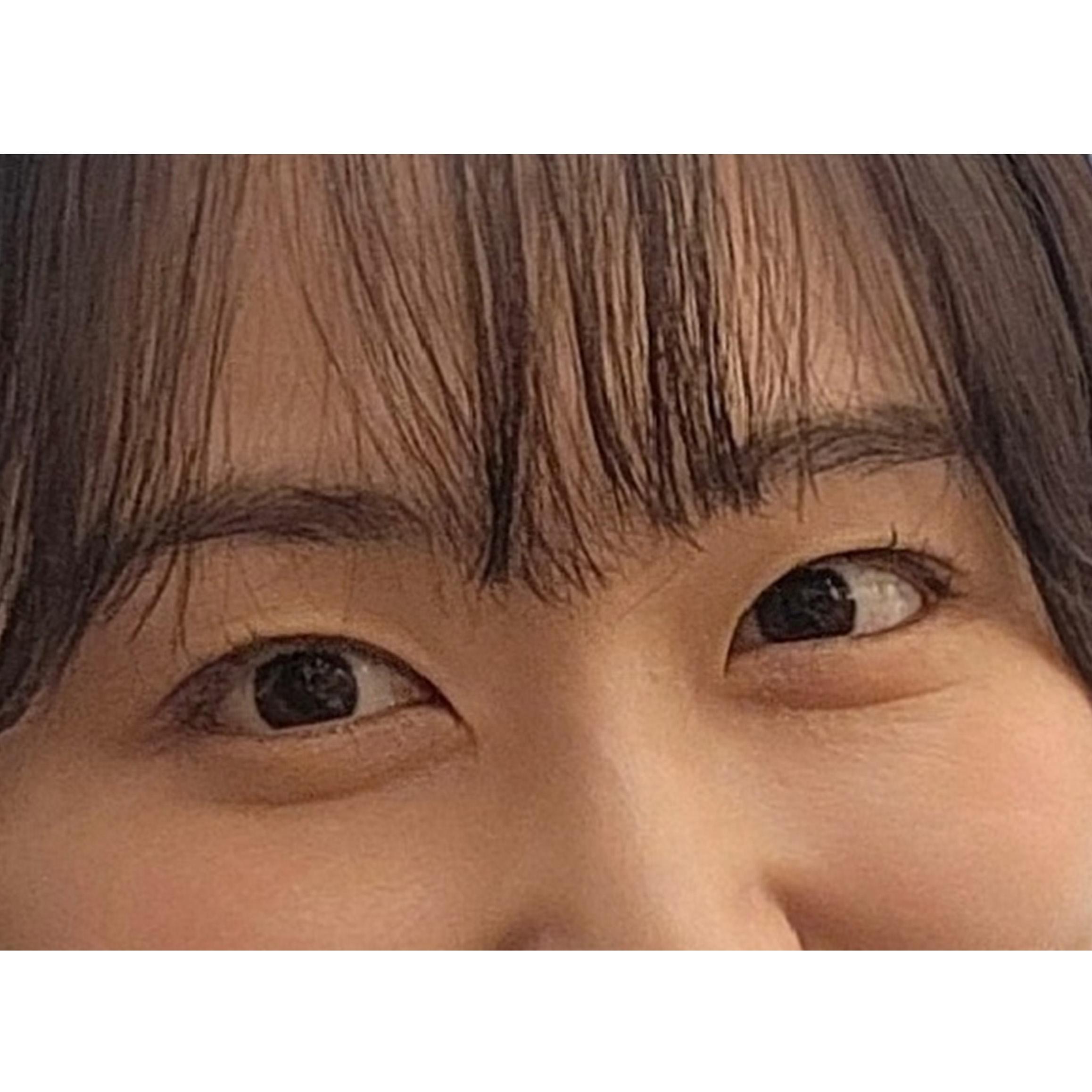 後