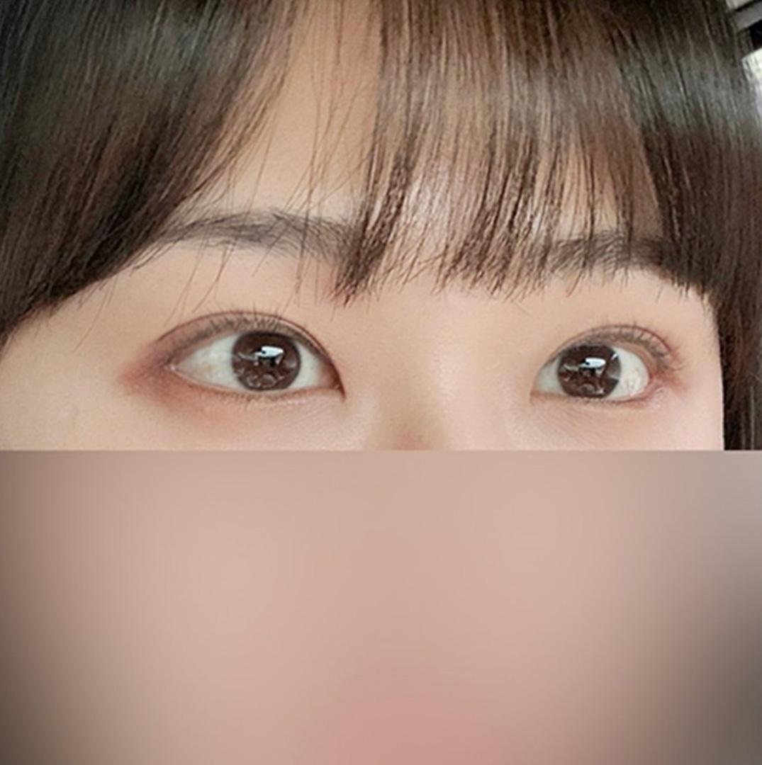 後